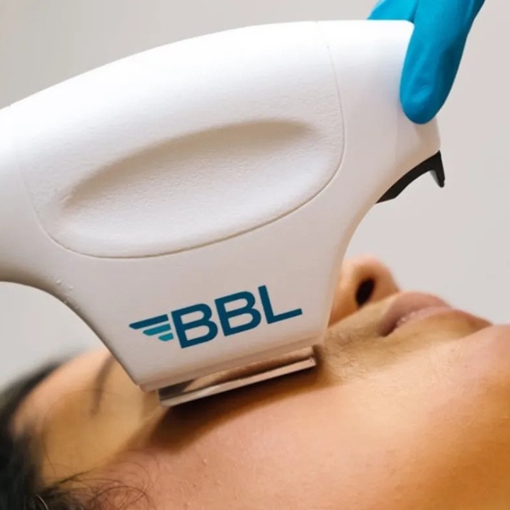 BBL-forever-bare-treatments-belleair-bluffs