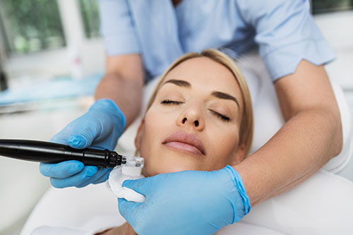 Microneedling Magic: How It Works and Why Your Skin Needs It