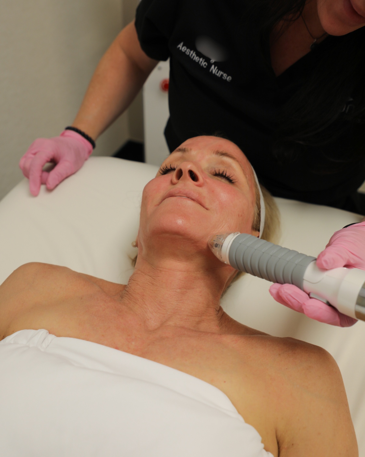 vivace-microneedling-treatments-available-belleairbluffs-1 vivace-microneedling-treatments-available-belleairbluffs-1