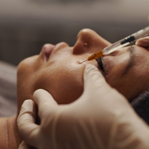 Close-up of a person receiving a cosmetic facial injection near the eye, with gloved hands stabilizing the face
